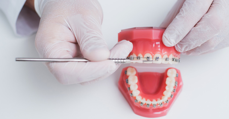 czym jest ortodoncja